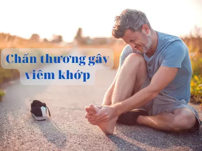 chan-thuong-la-nguyen-nhan-pho-bien-nhat-gay-viem-khop-ban-chan